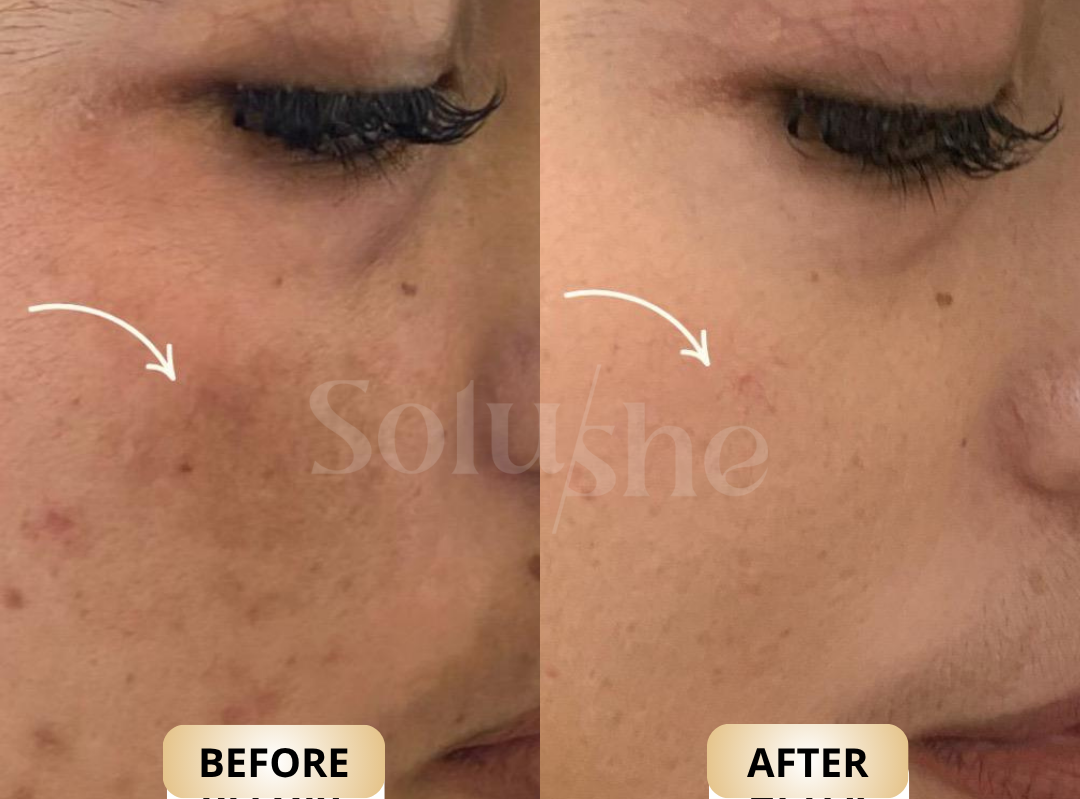 Hasil nyata before after Duo White Complex Solushe